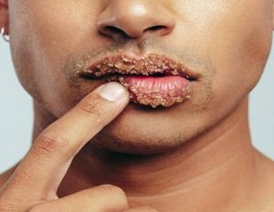 Lip Scrub